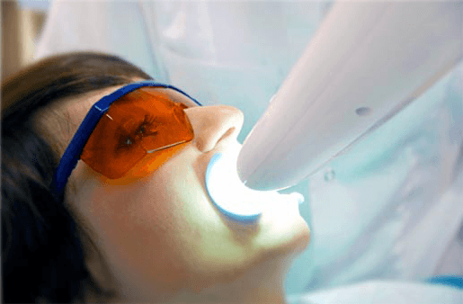 Understanding the Causes of Teeth Sensitivity Peterborough