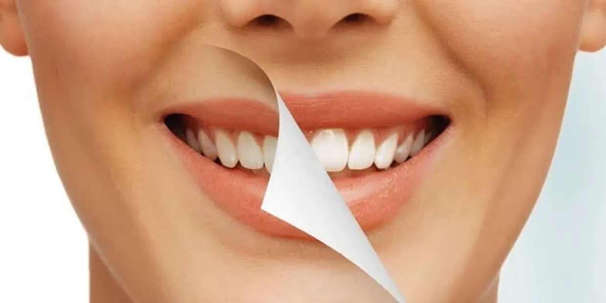 Why Is Nutrition So Important for Strong Teeth and a Healthy Smile Peterborough?