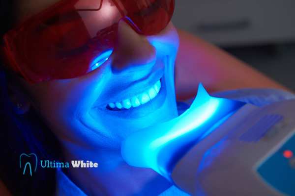 Professional Teeth Whitening Options Peterborough