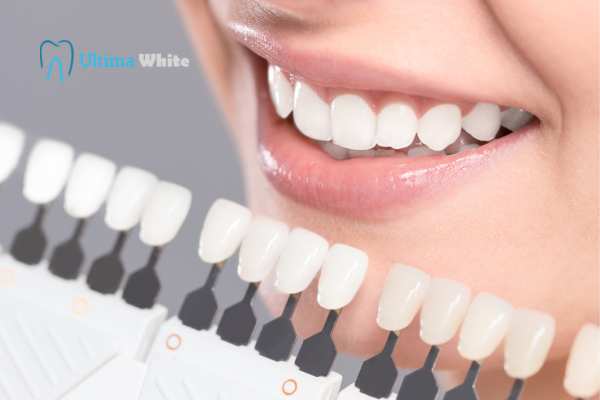 How to Maximise the Results of Your Laser Teeth Whitening Treatment Peterborough