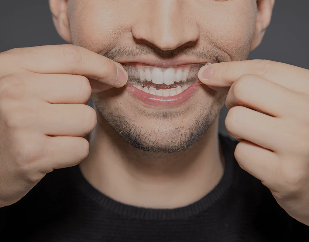 Can You Whiten Natural Teeth Without Harsh Chemicals Peterborough?