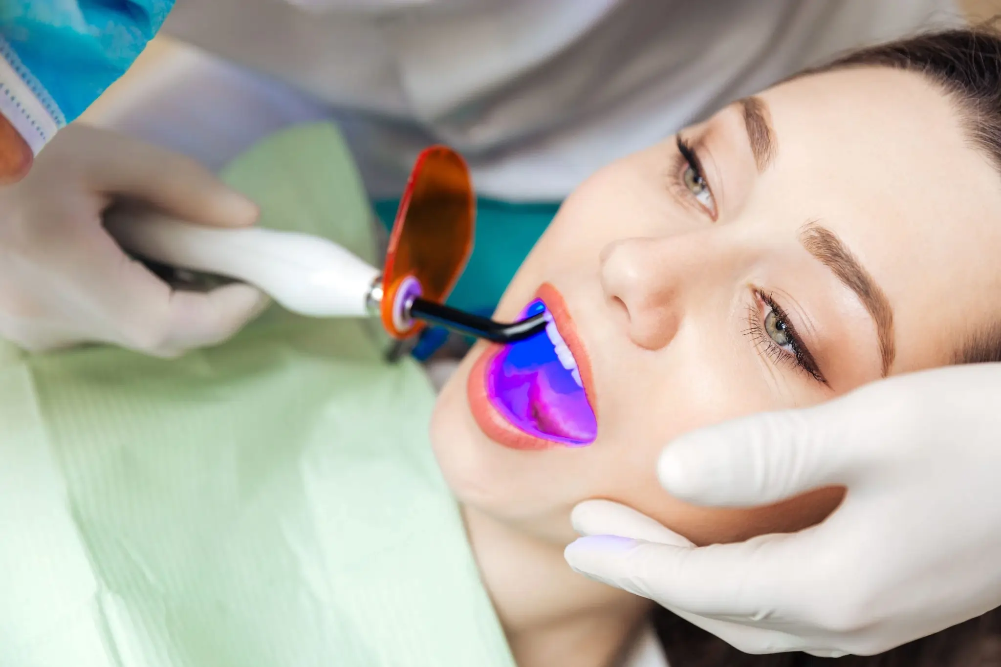 What Does Pain Feel Like During and After Laser Teeth Whitening Peterborough?