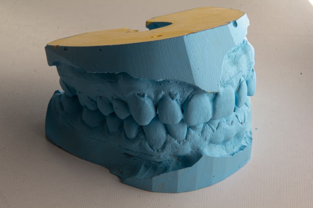 How Do Dental Implants Improve Jawbone Health and Oral Function Peterborough?