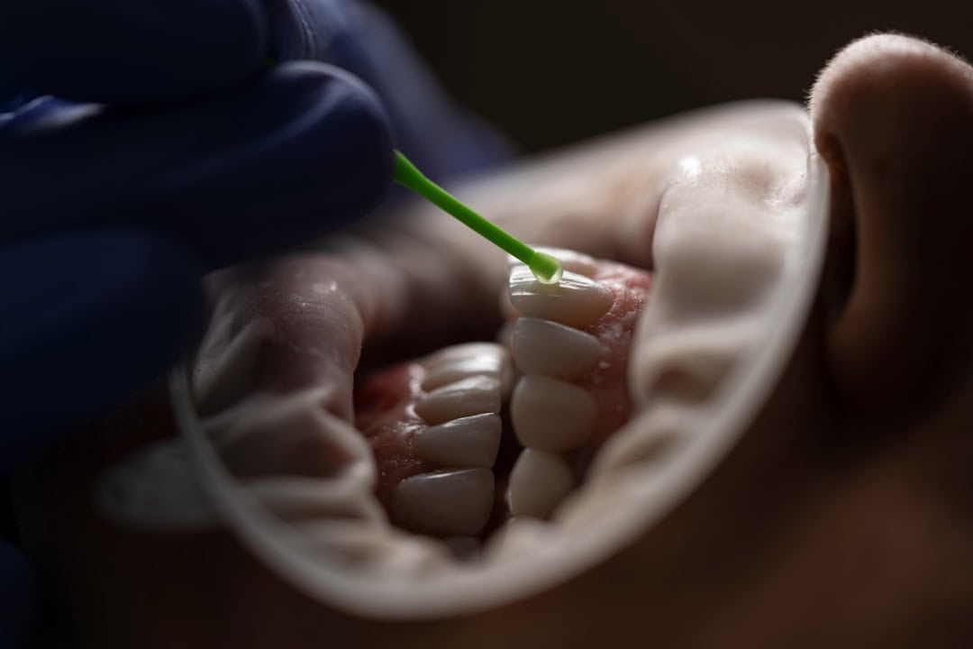The Role of Saliva: Nature’s Defense System Peterborough