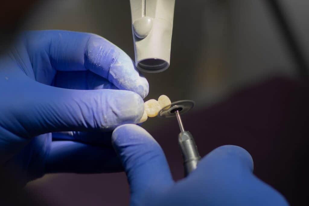 Customised Dental Solutions: Crowns, Aligners, and Implants Peterborough