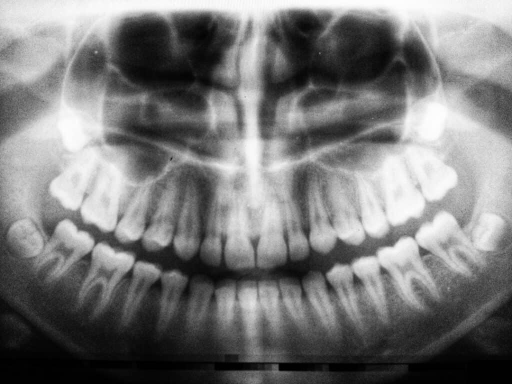The Future of 3D Printing in Oral Healthcare Peterborough